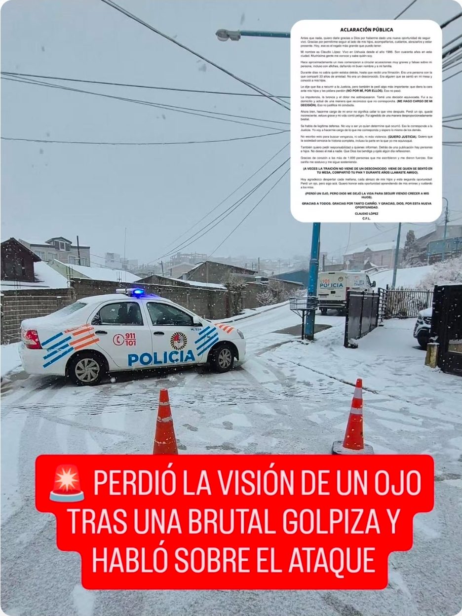 🚨 PERDIÓ LA VISIÓN DE UN OJO TRAS UNA BRUTAL GOLPIZA Y HABLÓ SOBRE EL ATAQUE